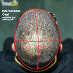Head Shape