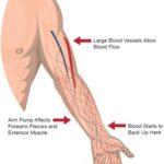 Arm-Pump-4268